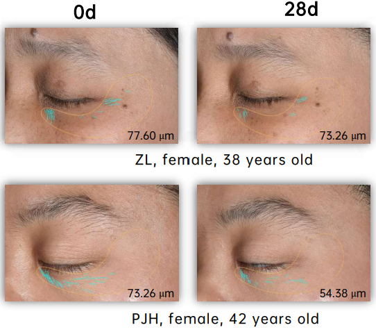 biomenta bf bifida ferment lysate clinical study-3